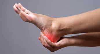 Plantar Fasciitis