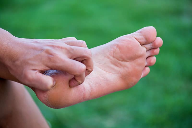 How To Alleviate The Symptoms Of Eczema On The Feet Walkrite Foot Clinic